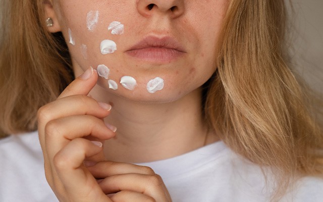 Gesunde Haut nach Verletzungen - Tipps zur Narbenpflege
